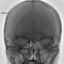 頭部血管（DA画像）