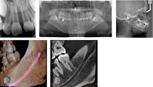 歯科(デンタル撮影)/パノラマ撮影/セファロ撮影/パノラマCT(3D画像)/パノラマCT(MPR画像)